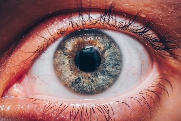 Czego objawem jest opuchnięcie oczu? Co zrobić, gdy spuchnie nam powieka? 